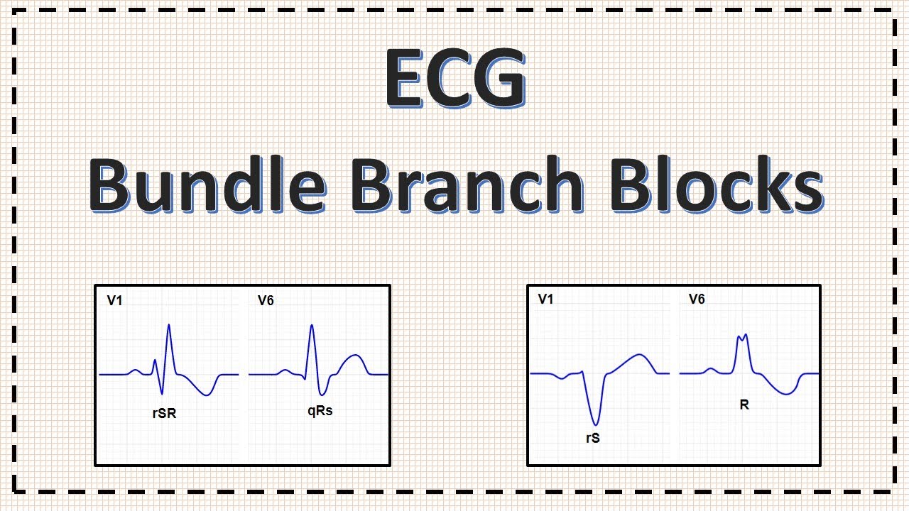 Bundle Branch Block | ECG | Right Bundle Branch Block | Left Bundle Branch Block | Explained