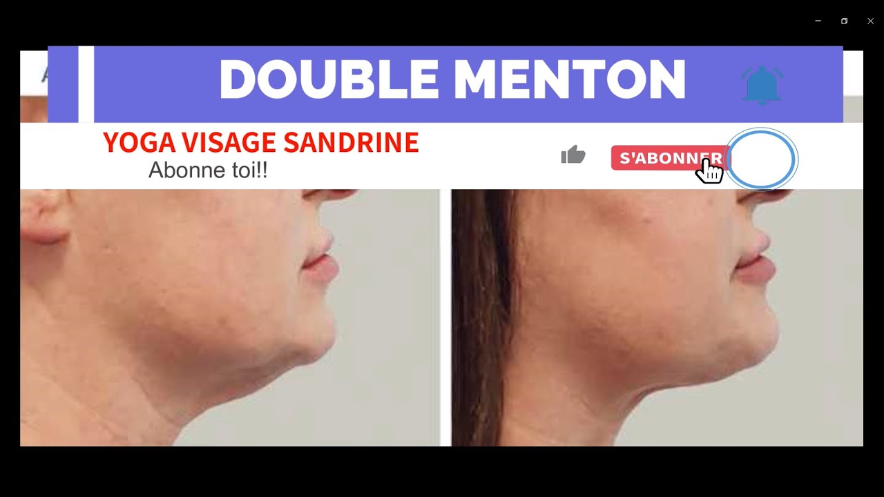 Устранение второго подбородка, лимфодренаж