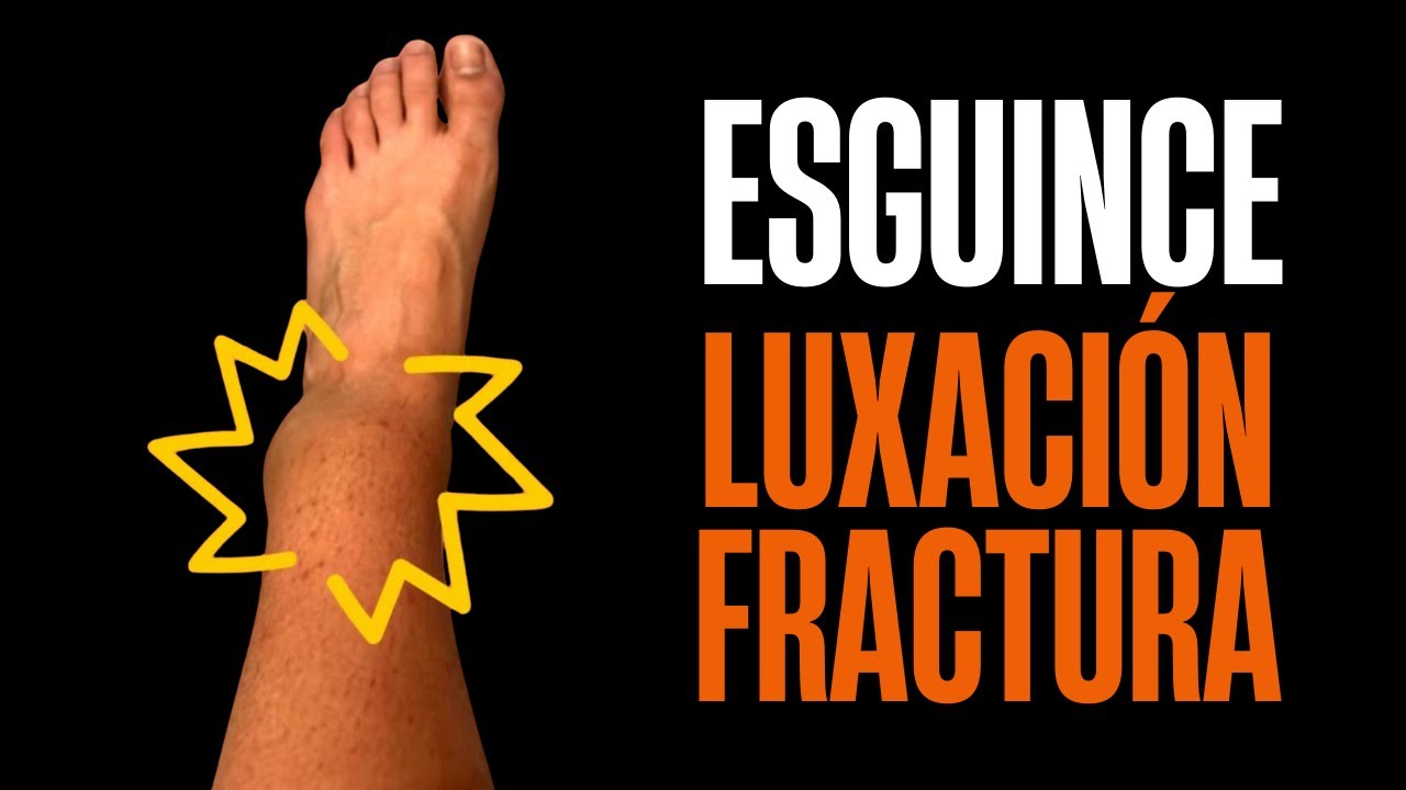 Esguince, luxación, fractura y contusión