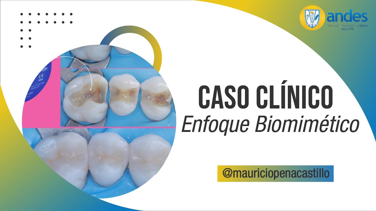 NUEVO Caso Clínico con Enfoque Biomimético