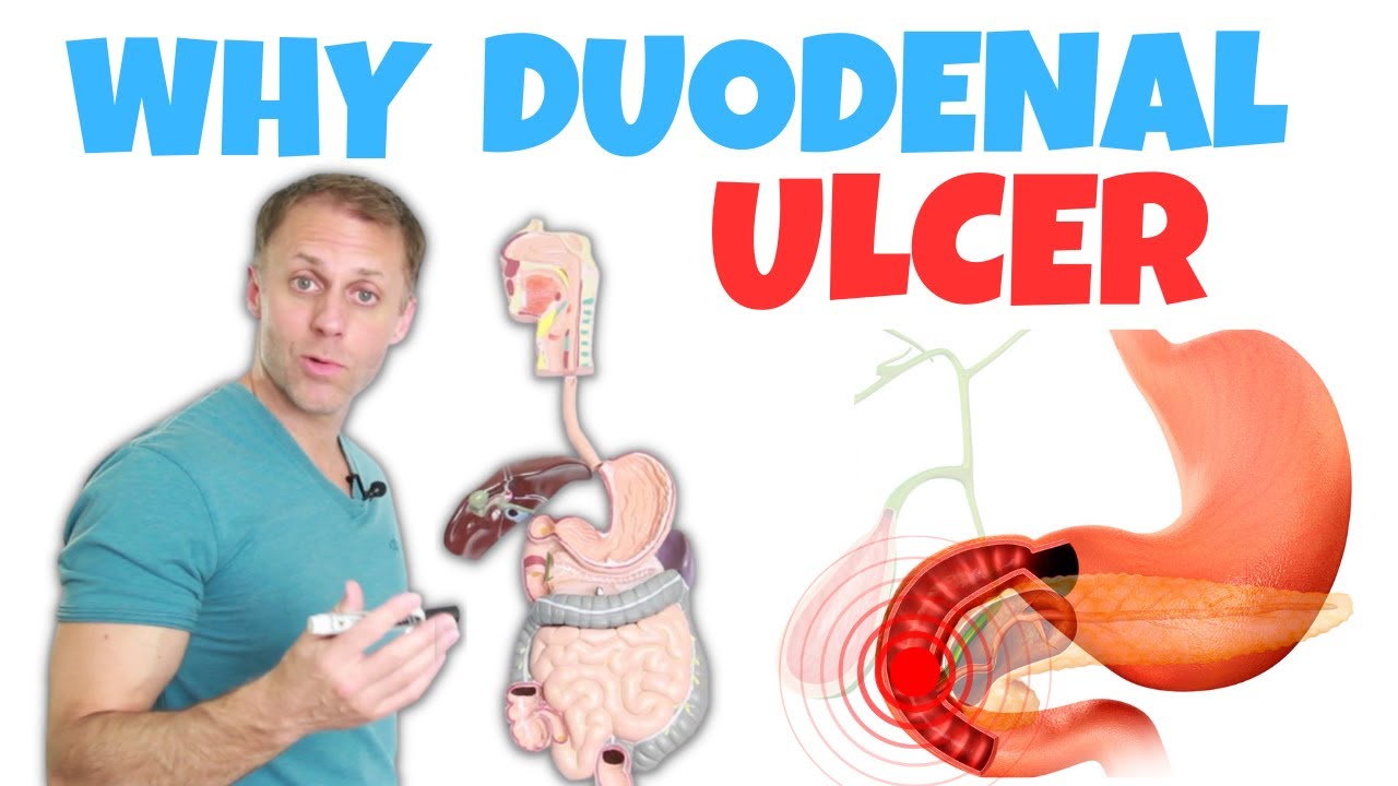 Understanding a Duodenal Ulcer