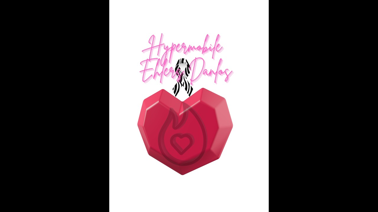 003: Hypermobile Ehlers Danlos - hEDS