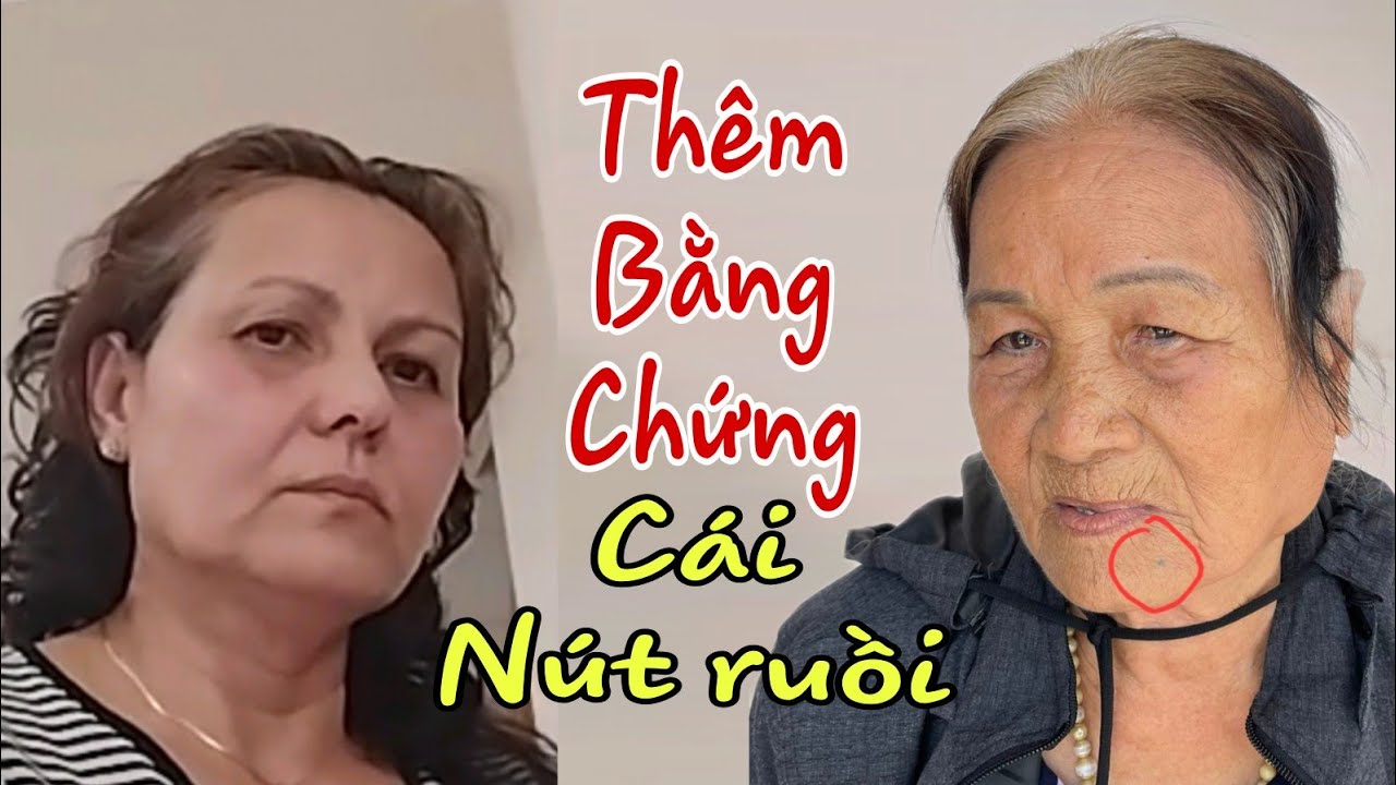 Cô Lụa có cái Nút Ruồi như Chị Hoa mô tả.  Bàng chứng sống là đây.TV tin rằng đây là Mẹ chị Hoa