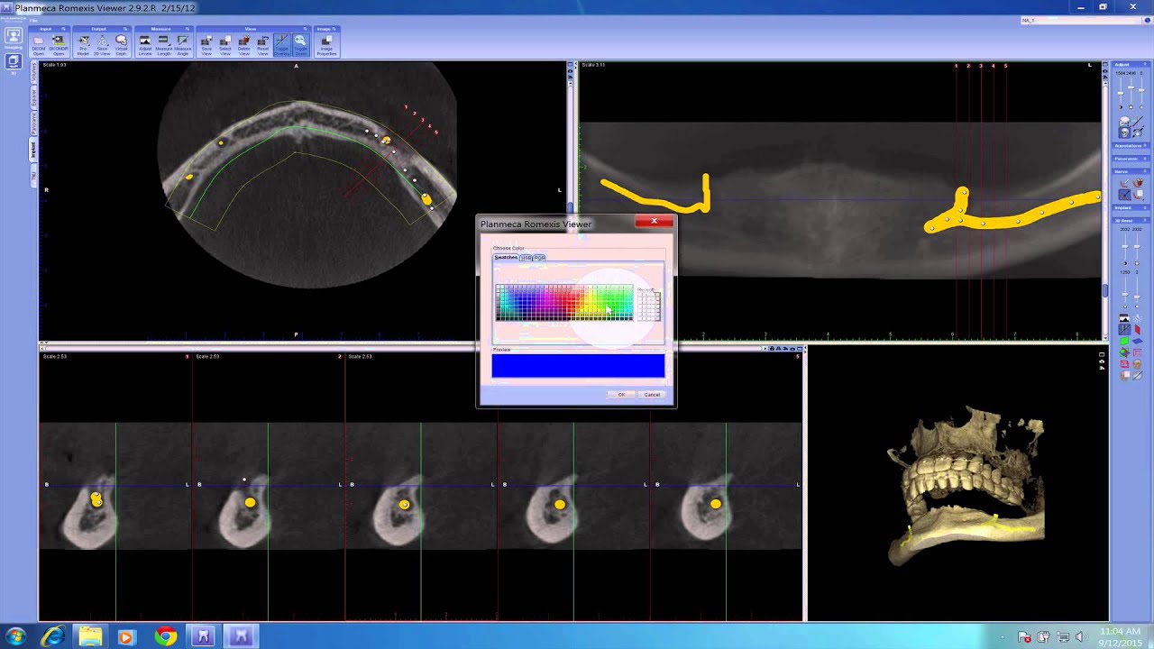 Romexis CBCT Software