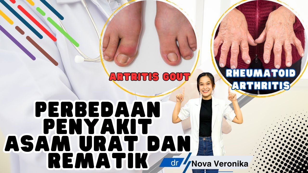 Perbedaan penyakit asam urat dan rematik 
