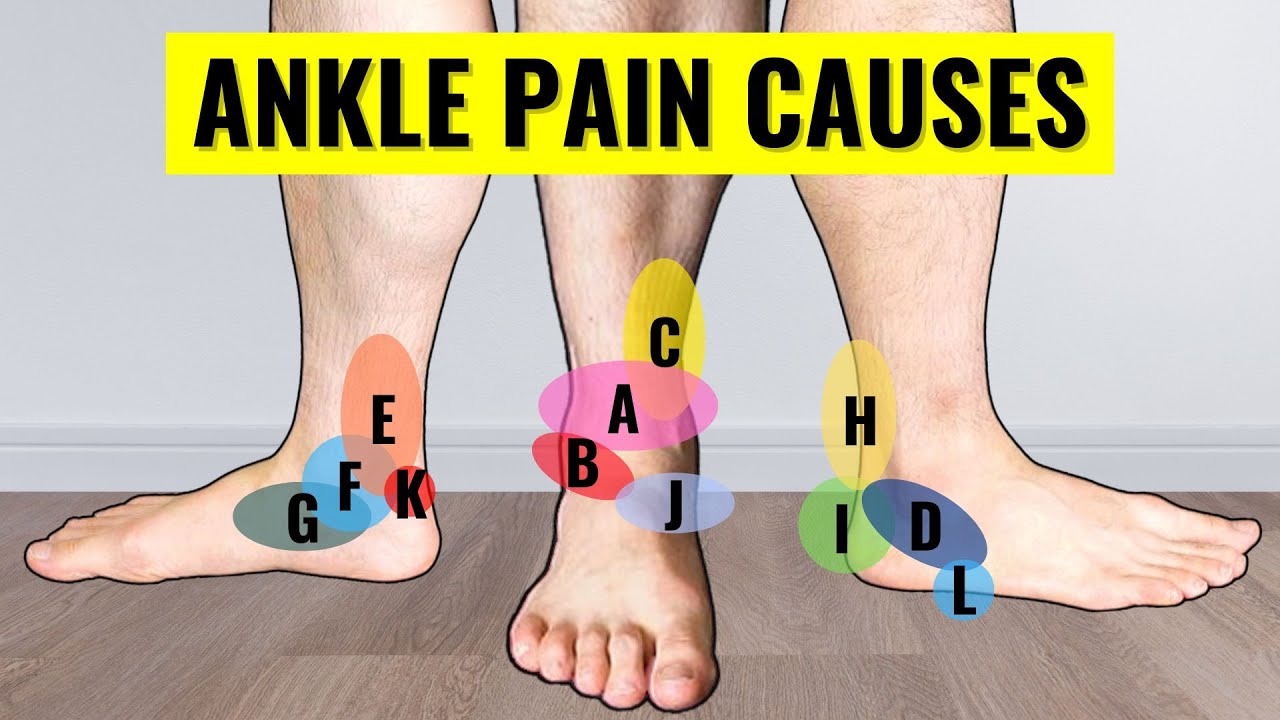 Вот почему болит лодыжка: проблемы и типы боли в лодыжке по месту