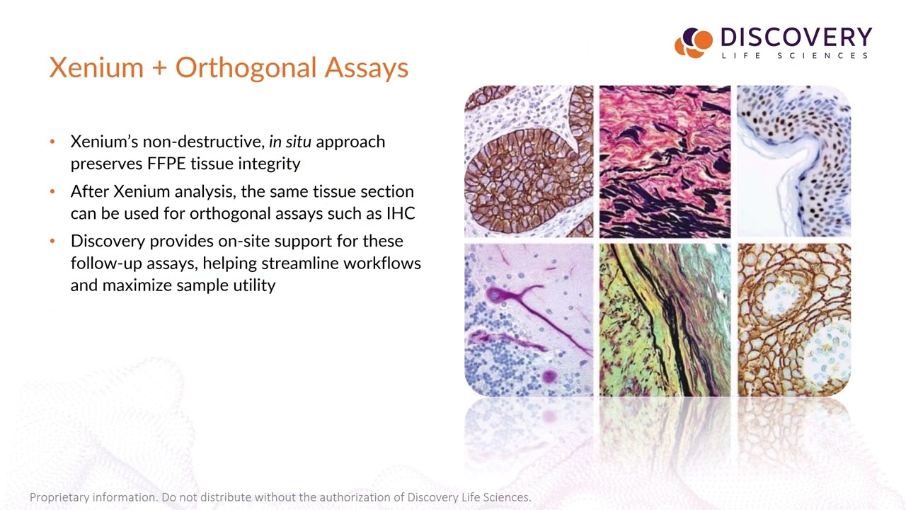 From Sample to Insight: ​In Situ Spatial Biology with Xenium