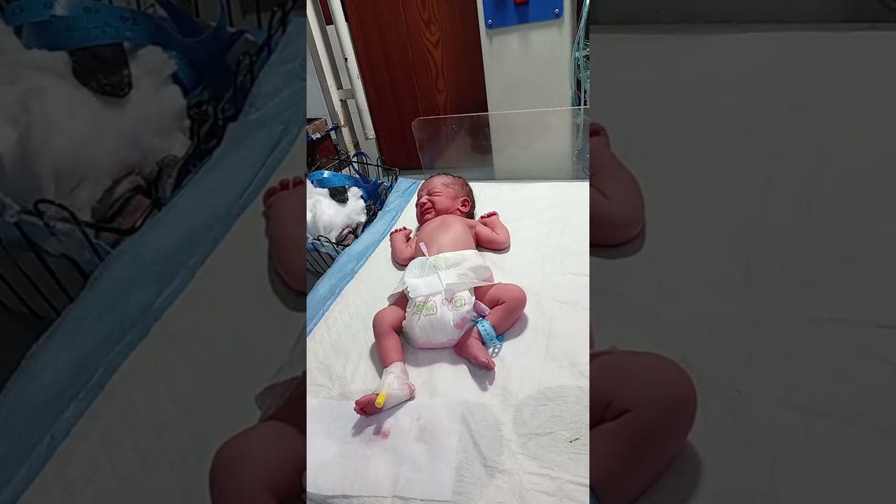 Mashallah 💖 Microsomic Baby Feeding TimeTiny Fighter’s Feeding Time 🍼