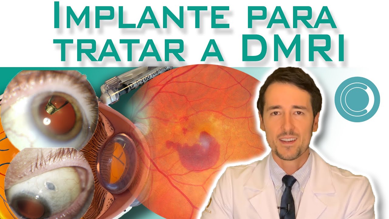 Novo tratamento para DMRI - Fim das inje&ccedil;&otilde;es intrav&iacute;treas de antiangiog&ecirc;nico?