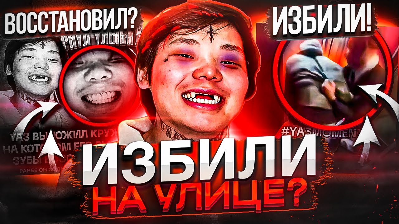 YA3 ВЫБИЛИ ЗУБЫ! ЧТО СЛУЧИЛОСЬ? / ФАНЫ ТЕХНИКА ПРОТИВ ЦОЯ / ДАРЬЯНА, BABY MELO & ЭВЕЛОН