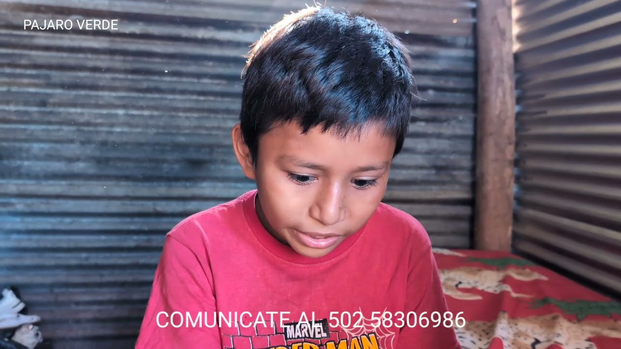 Jorge Luis tiene sueños como cualqier otro pero no se acuerda qe le dan convulsiones.La madre sufre