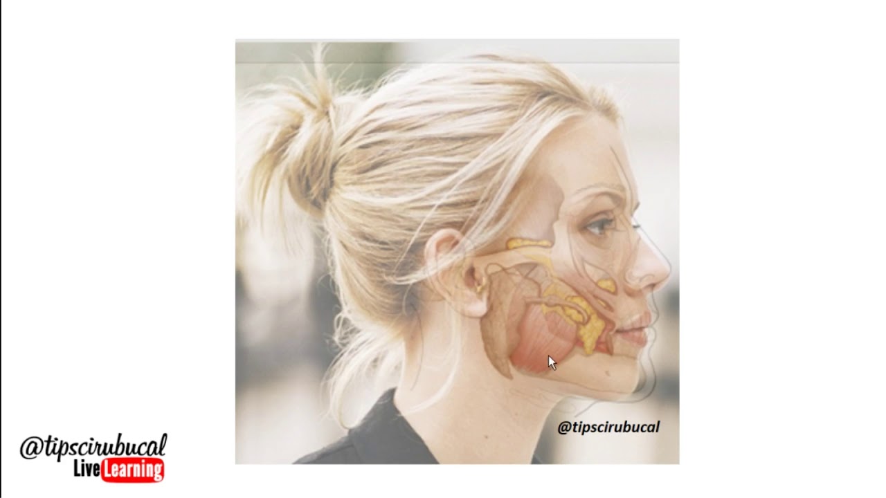 Anatomía de la Bichectomia / Bichat tipscirubucal Dr. Carlos Petit Lorusso