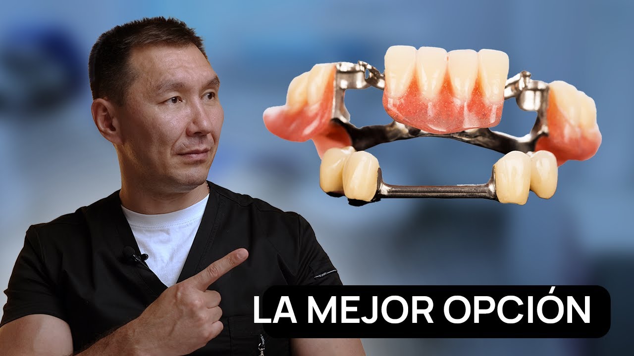 LA MEJOR pr&oacute;tesis dental REMOVIBLE del 2025. Los dentistas guardan silencio al respecto.