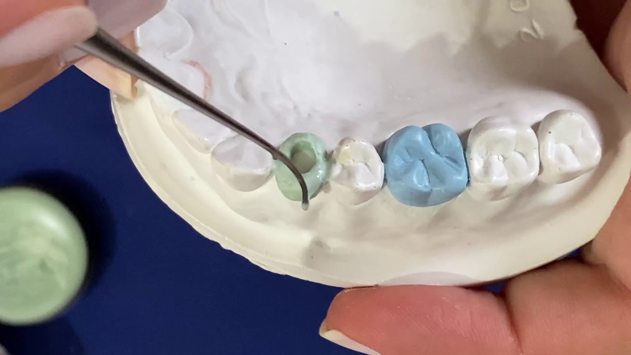 Como encerar un premolar FACIL! Premolar Wax up!