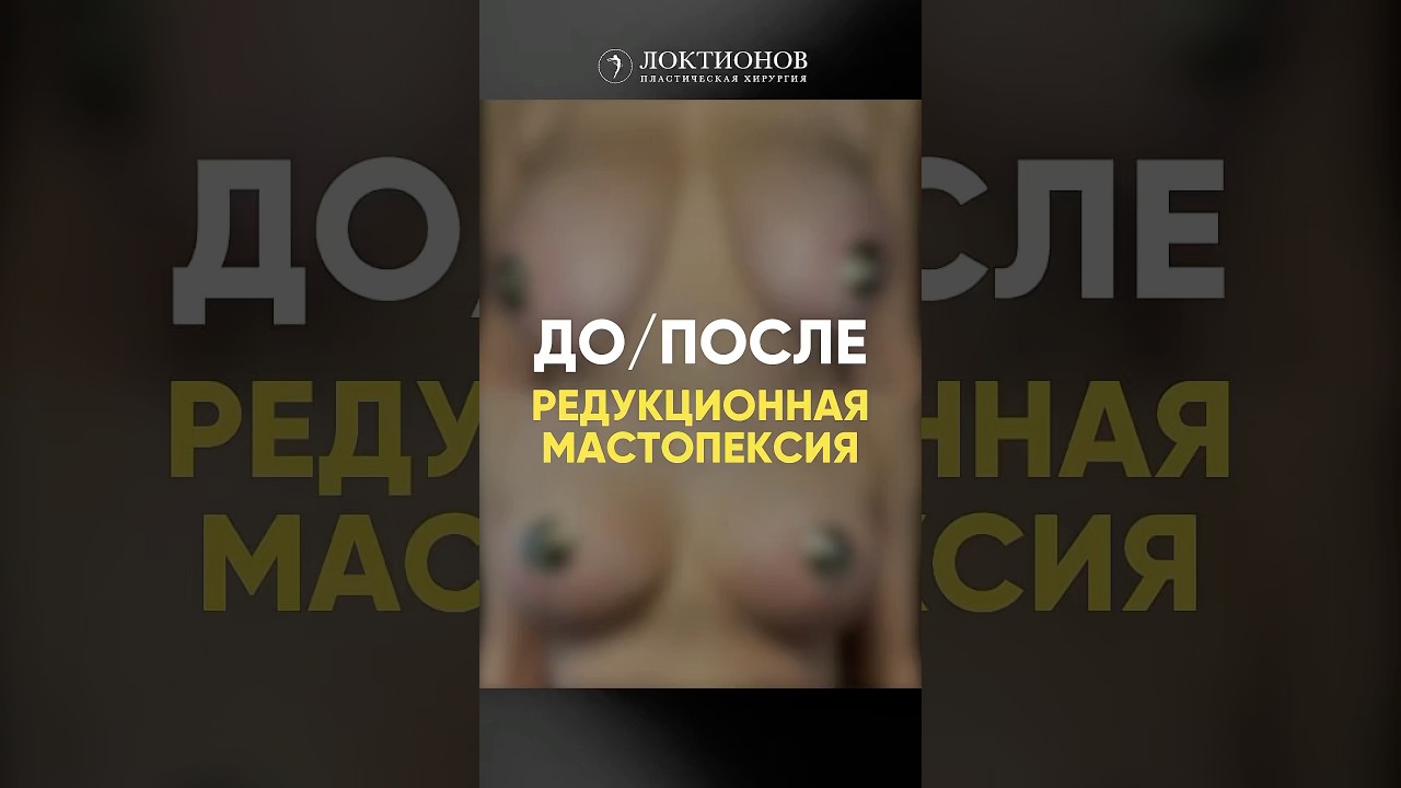 АСИММЕТРИЯ большой груди🤔 