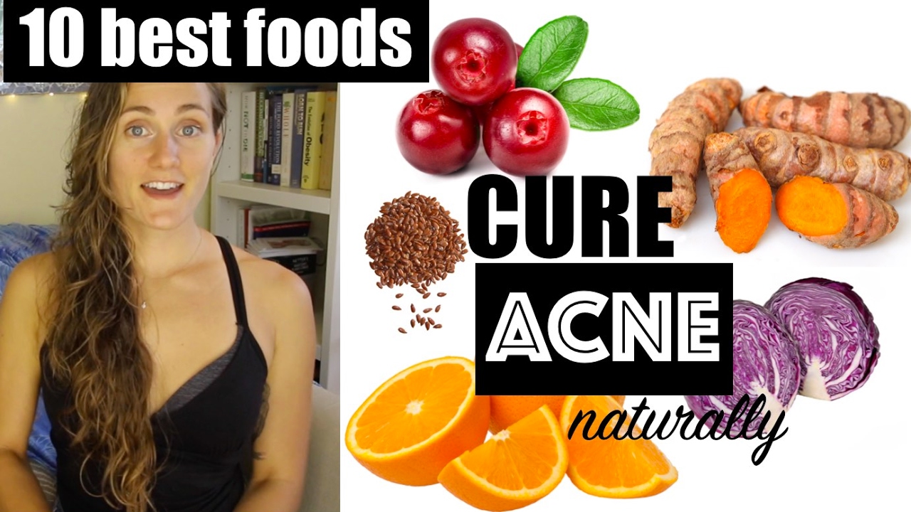 Top 10 BEST Foods to Cure Acne Naturally - The Acne Series