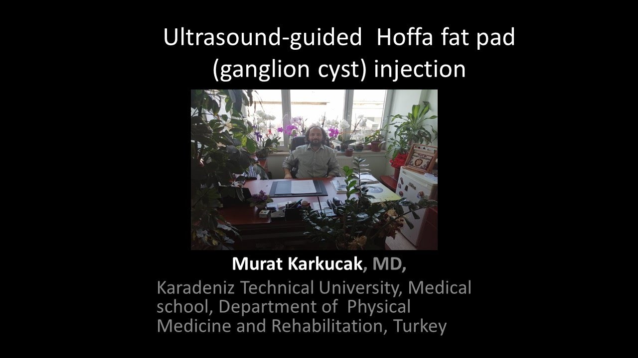 Ultrasound-guided  Hoffa fat pad (ganglion cyst) injection, by Prof Murat Karkucak MD