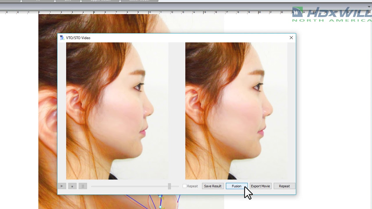 Will-Ceph: Orthodontic Software