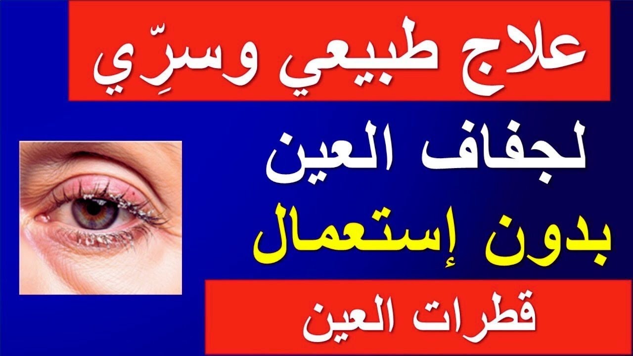 تعاني من جفاف العين؟ هذه الطرق الطبيعية أنقذت عينيّ بدون أي قطرة