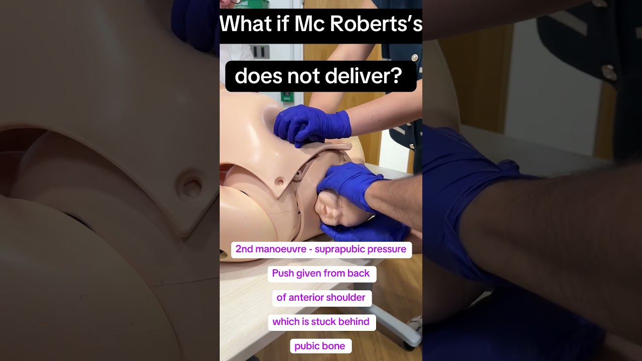 Shoulder Dystocia: Obstetric Emergency Management