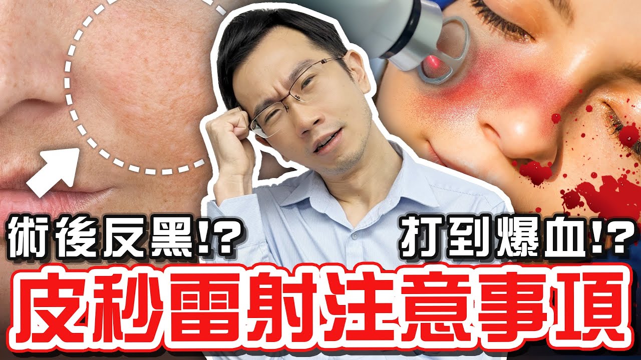 皮秒雷射打到出血才有效? 術後反黑怎麼辦?