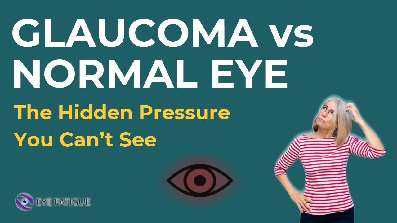 Glaucoma Eye vs Normal Eye: The Hidden Pressure You Can’t See