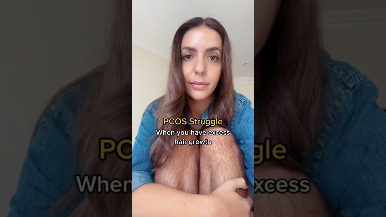 When you have excess hair growth with #pcos
