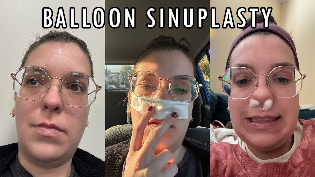 Balloon Sinuplasty Recovery | Vlogmas 2025