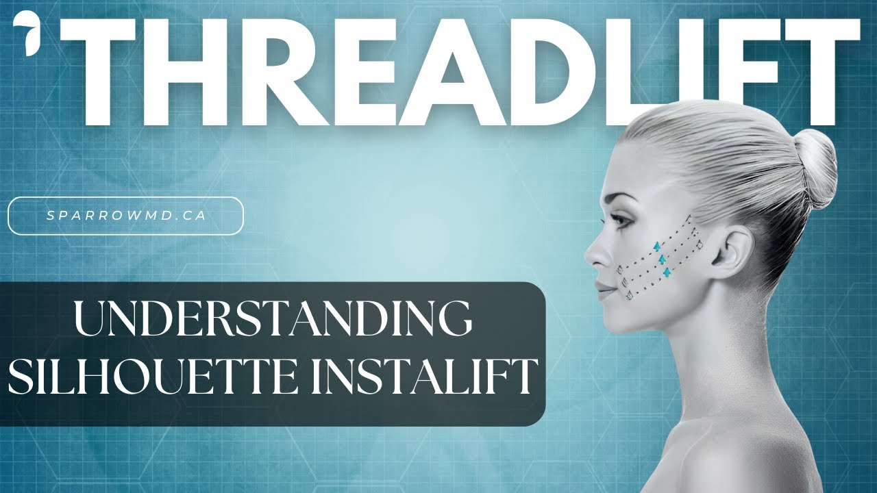 Threadlift - Silhouette Instalift Top 10 Facts