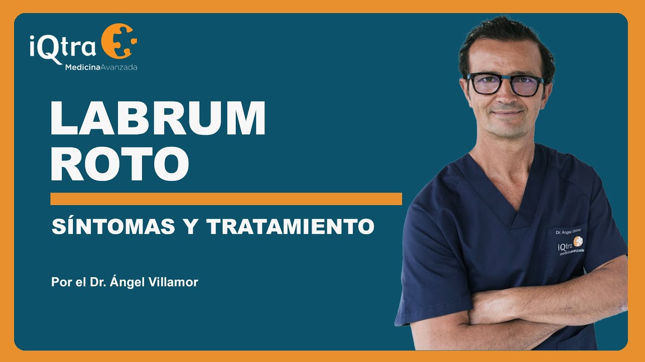 &iquest;Tienes dolor de cadera por un LABRUM ROTO? Descubre los s&iacute;ntomas y tratamiento