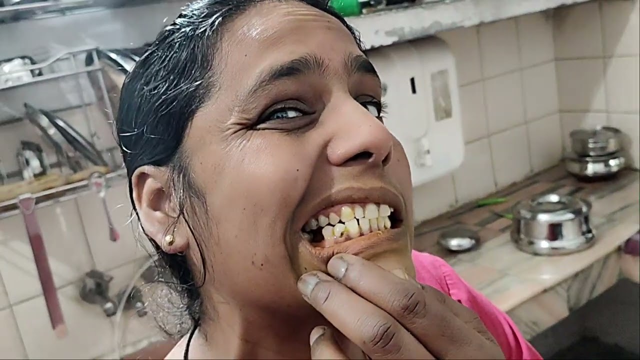 Mummy ke dant Mein kida Laga 😱😱 | Shaurya Dalak | #shauryadalak #viral #vlog #vlogger 