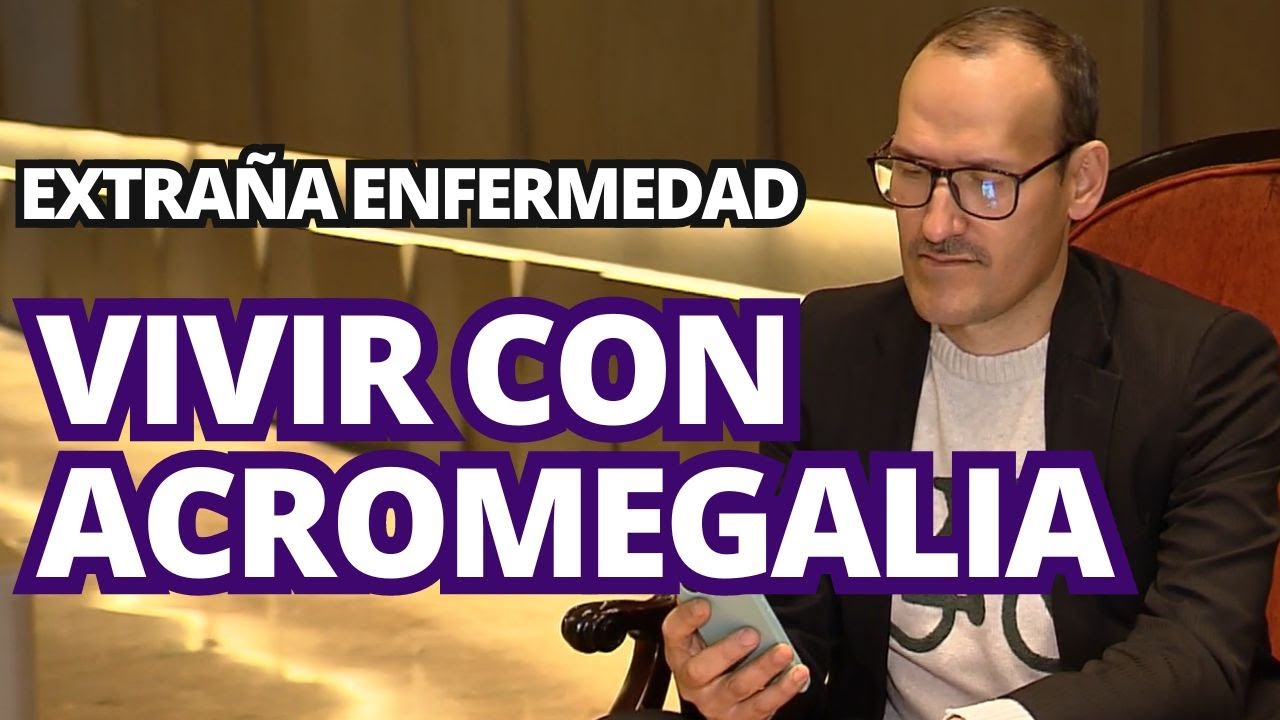 Qué es la acromegalia: impacto y tratamiento de esta rara enfermedad