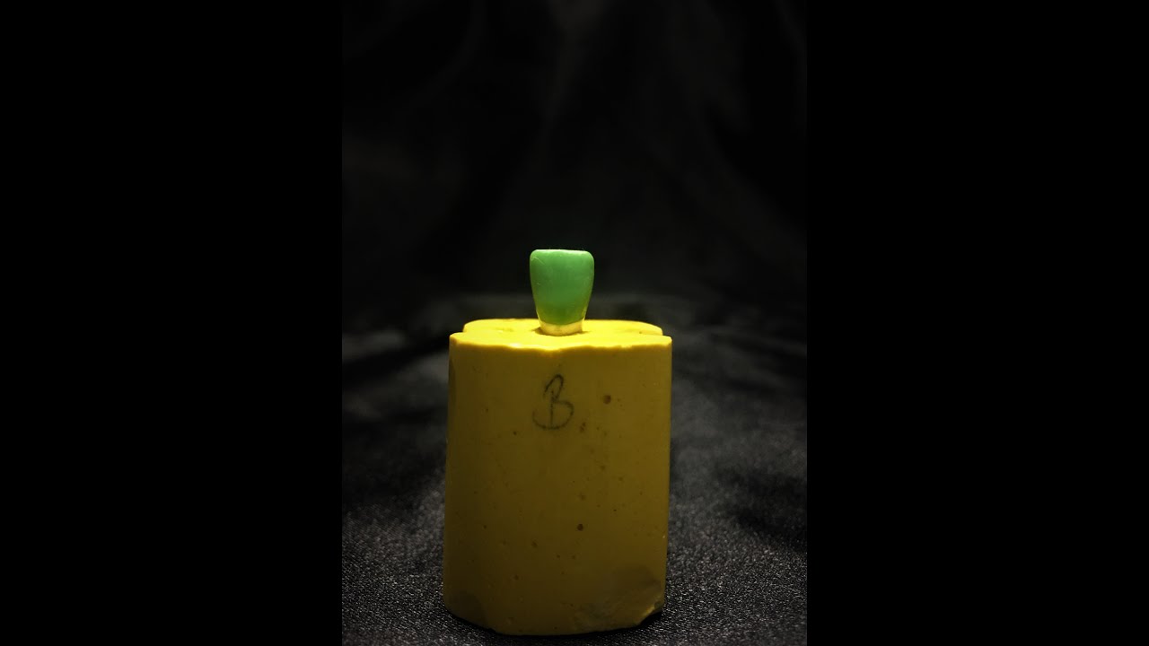 Maksiller Sağ Santral Diş Modelajı-Maxillary Right Central Incisor Wax Up