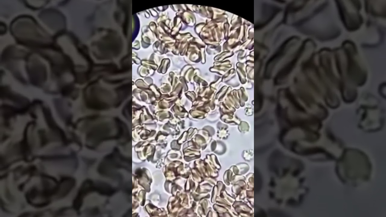 Covid 19 blood under the microscope 🔬 #reels #microscope #viral #covid19 #covid #coronavirus #lab