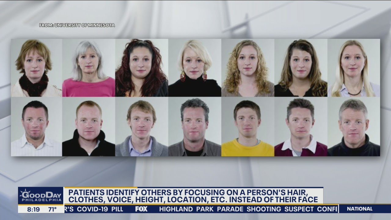 Face Blindness: Understanding Prosopagnosia and its effects