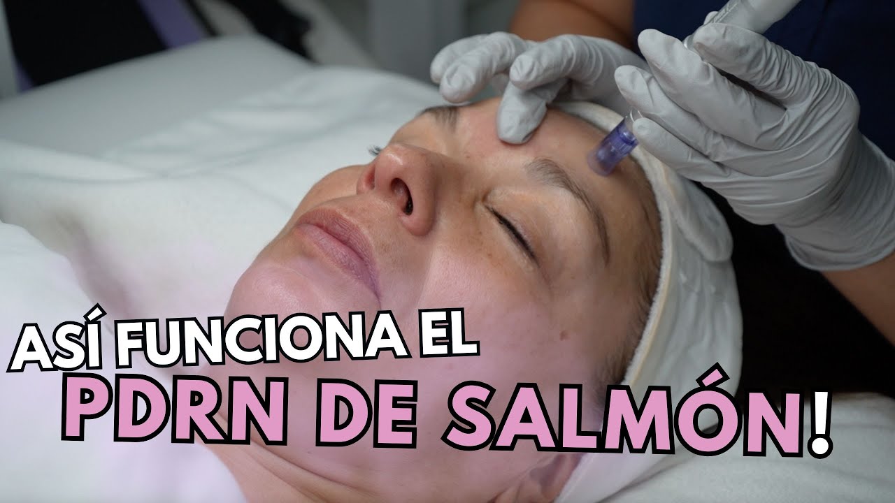 Así funciona el PDRN de salmón: Explicación y Protocolo 🌟