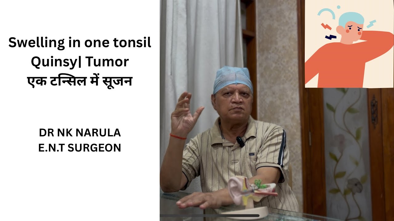 Swelling in one tonsil  | एक टन्सिल में सूजन | Quinsy | Tumor | Symptoms and solutions 