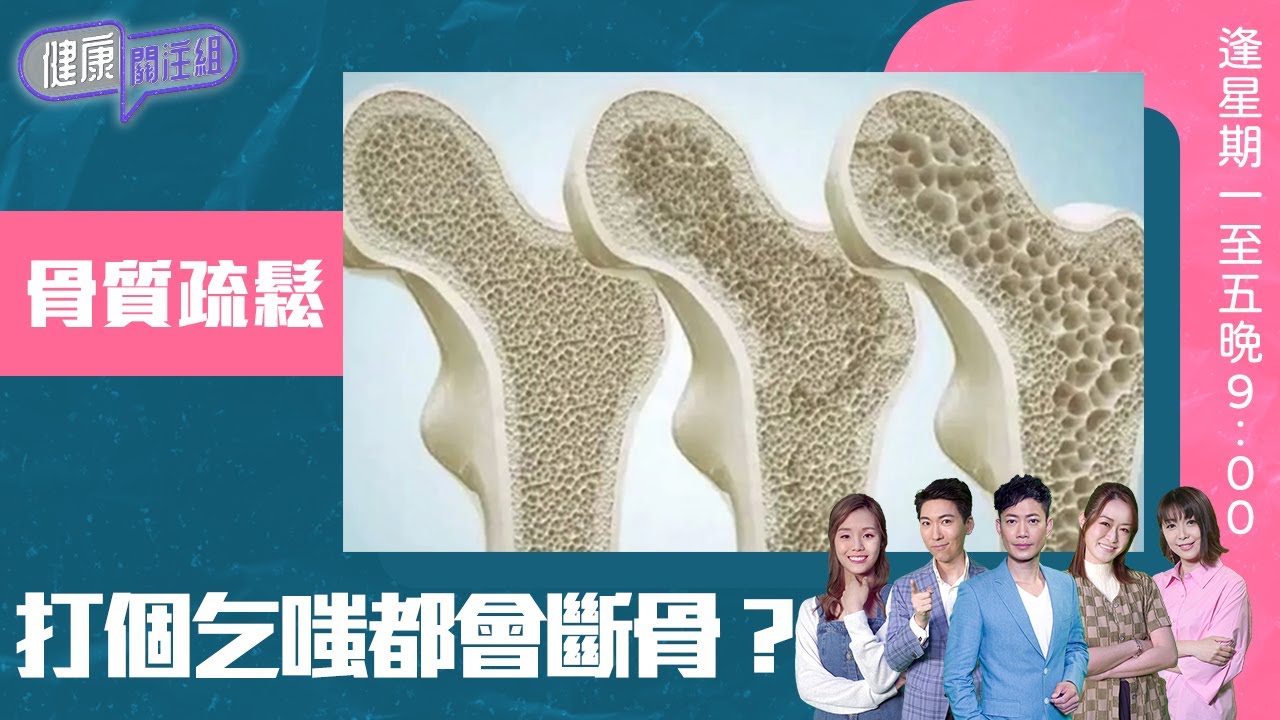 健康關注組 ｜ 「骨質疏鬆」打個乞嗤都會斷骨 ？｜ HOY TV 77台 ｜ 敖嘉年 ｜ 黃芳雯 ｜林曉蕙｜第52集
