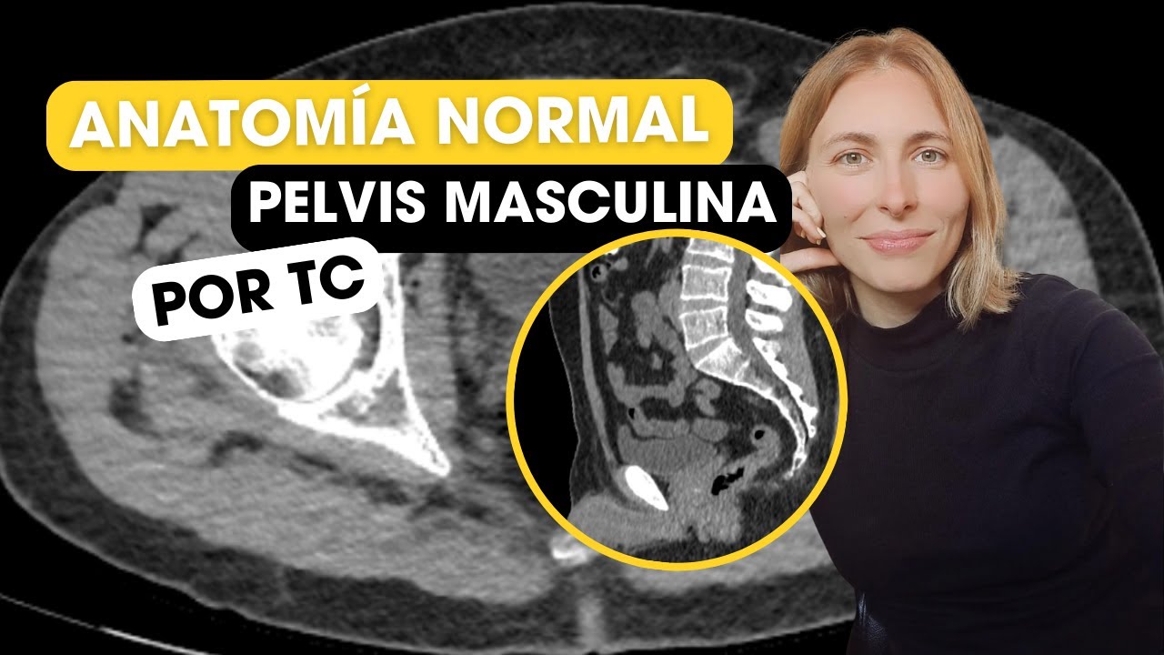 Anatomía de pelvis masculina por Tomografía ✅