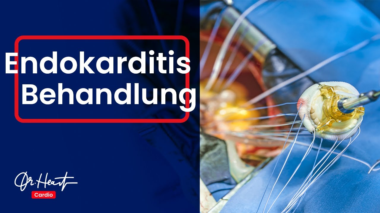 Endokarditis - Symptome und Behandlung | Dr.Heart