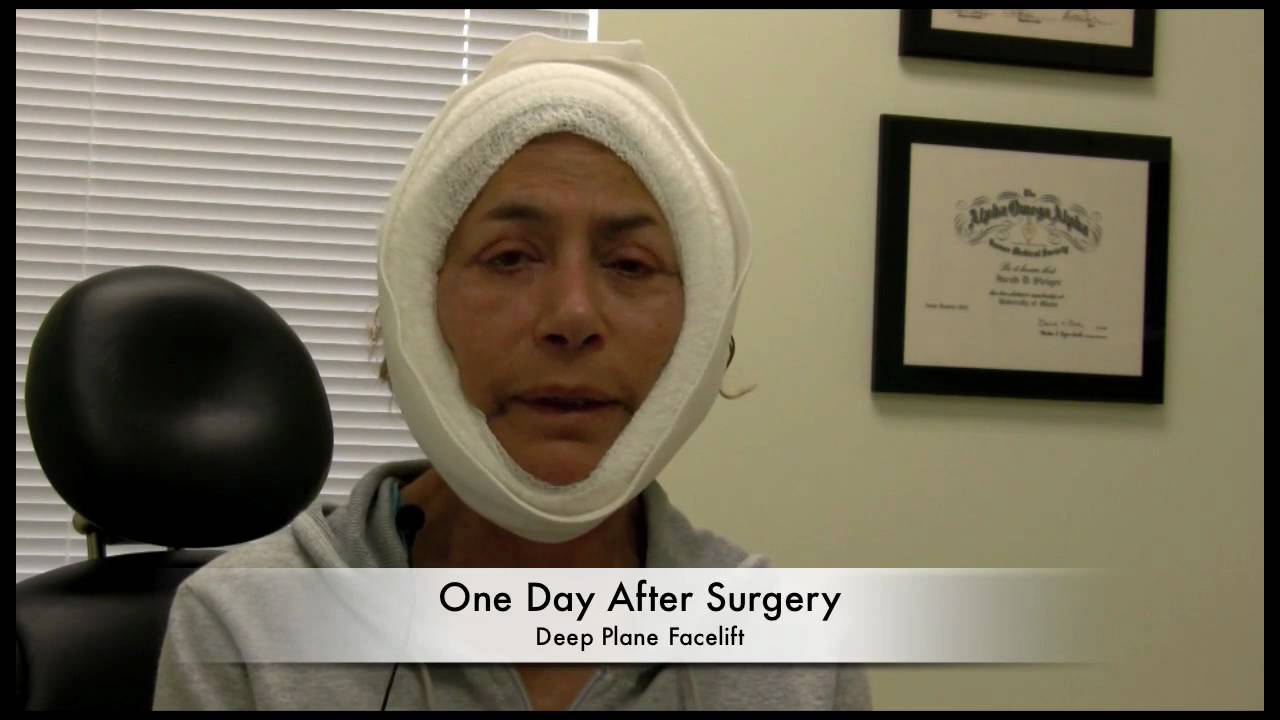 Video Journey: Deep Plane Face lift,  Part 2 (Standard Definition)