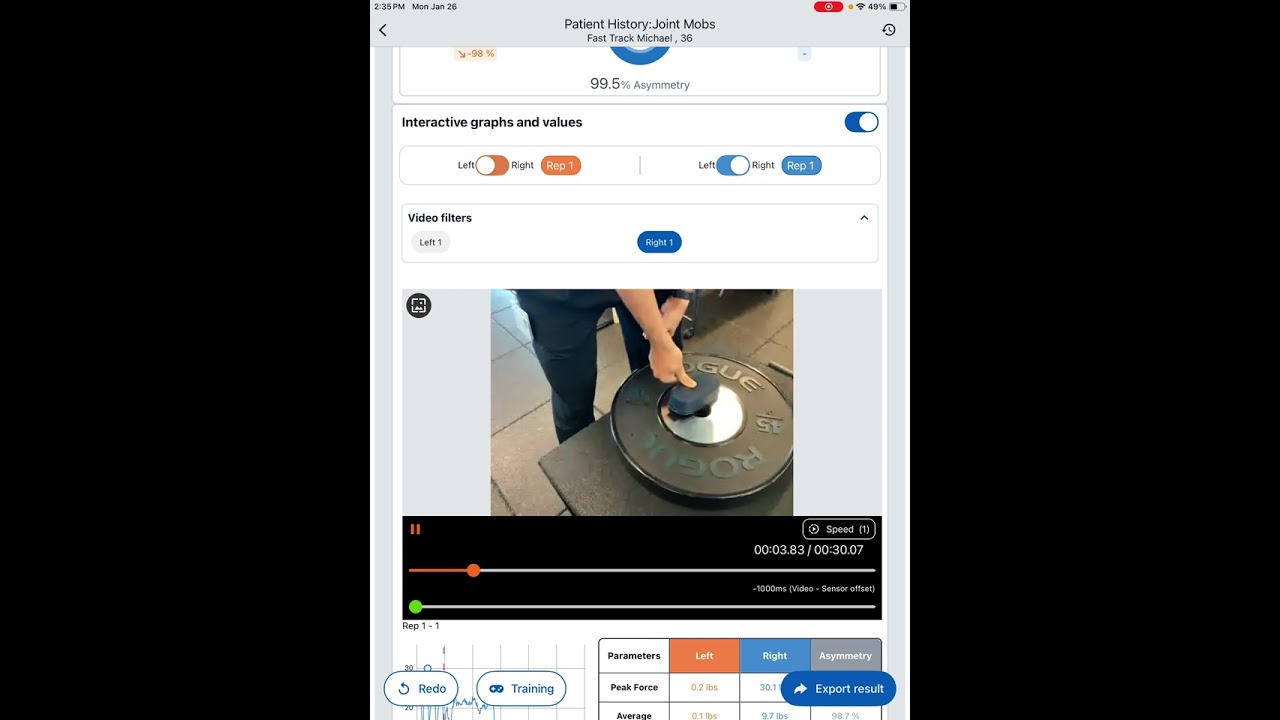 KINVENT - MANUAL THERAPY JOINT MOBILIZATION TRAINING & BIOFEEDBACK FOR CLINICIANS K PUSH