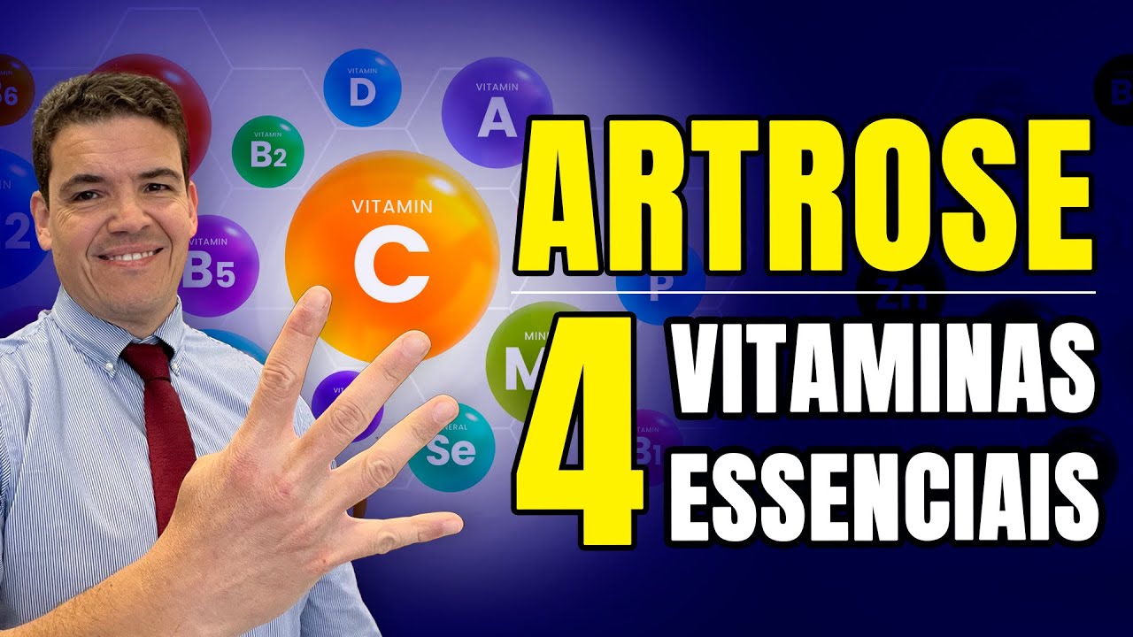 ARTROSE - 4 Vitaminas ESSENCIAIS! 💊