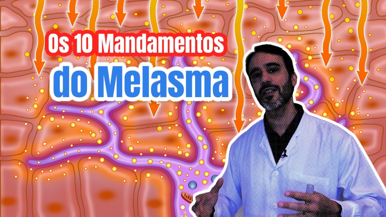 OS 10 MANDAMENTOS do MELASMA