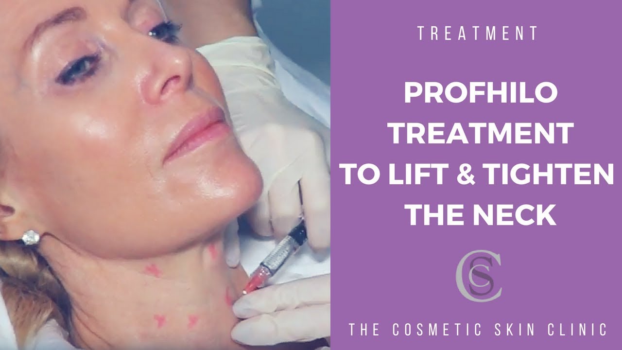 Profhilo Treatment To Lift And Tighten The Neck | The Cosmetic Skin Clinic