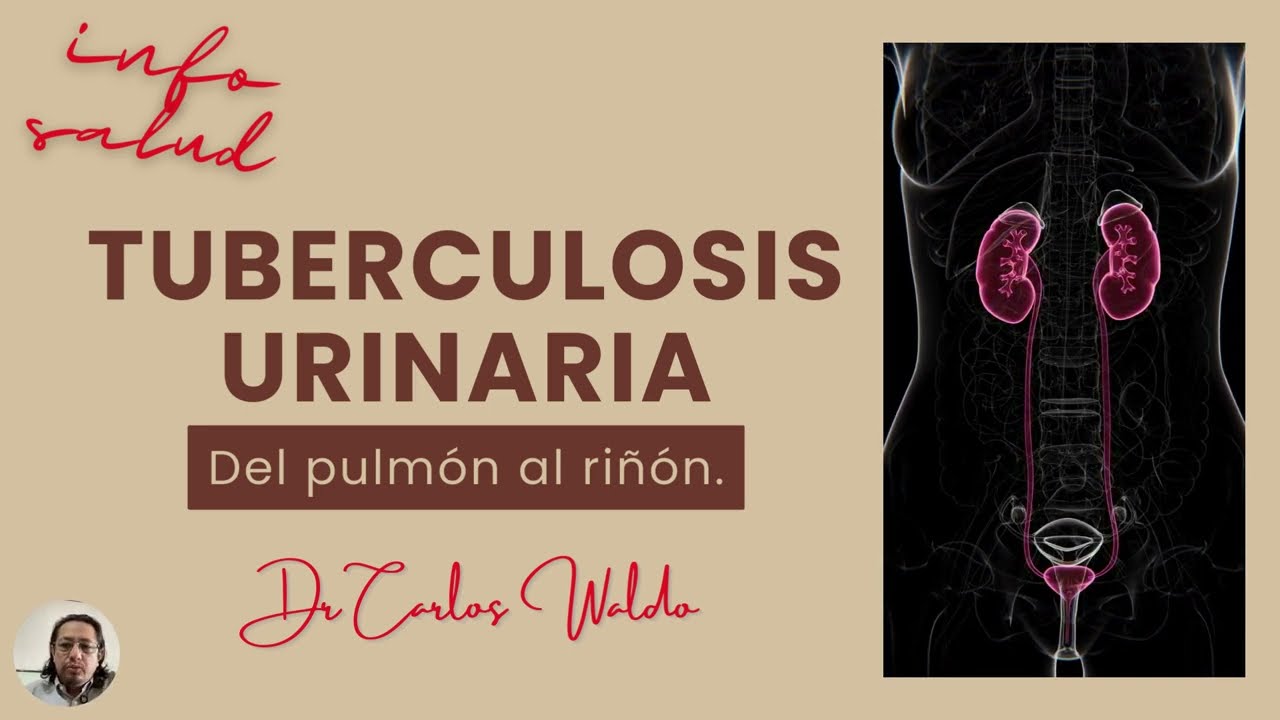 TUBERCULOSIS URINARIA  Del pulmón al riñón