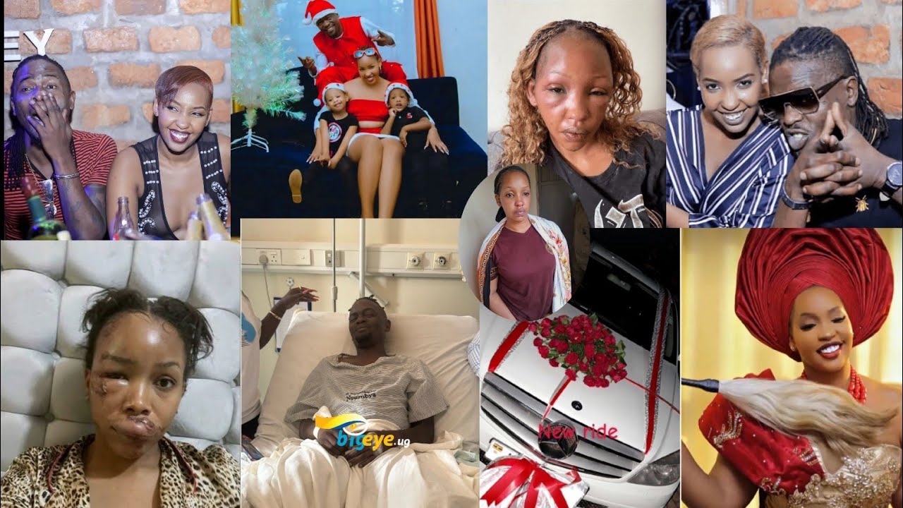 💔Iyi ndwara Teta sandra arwaye yatumye yari yivuganye umugabo we, urebe neza niba nawe utayirwaye😭😭