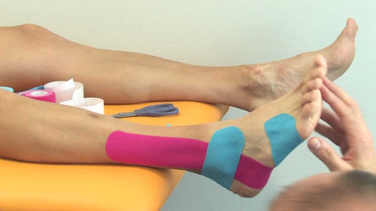 Kinesiology taping - Tejping kotníku oboustranně - varianta II