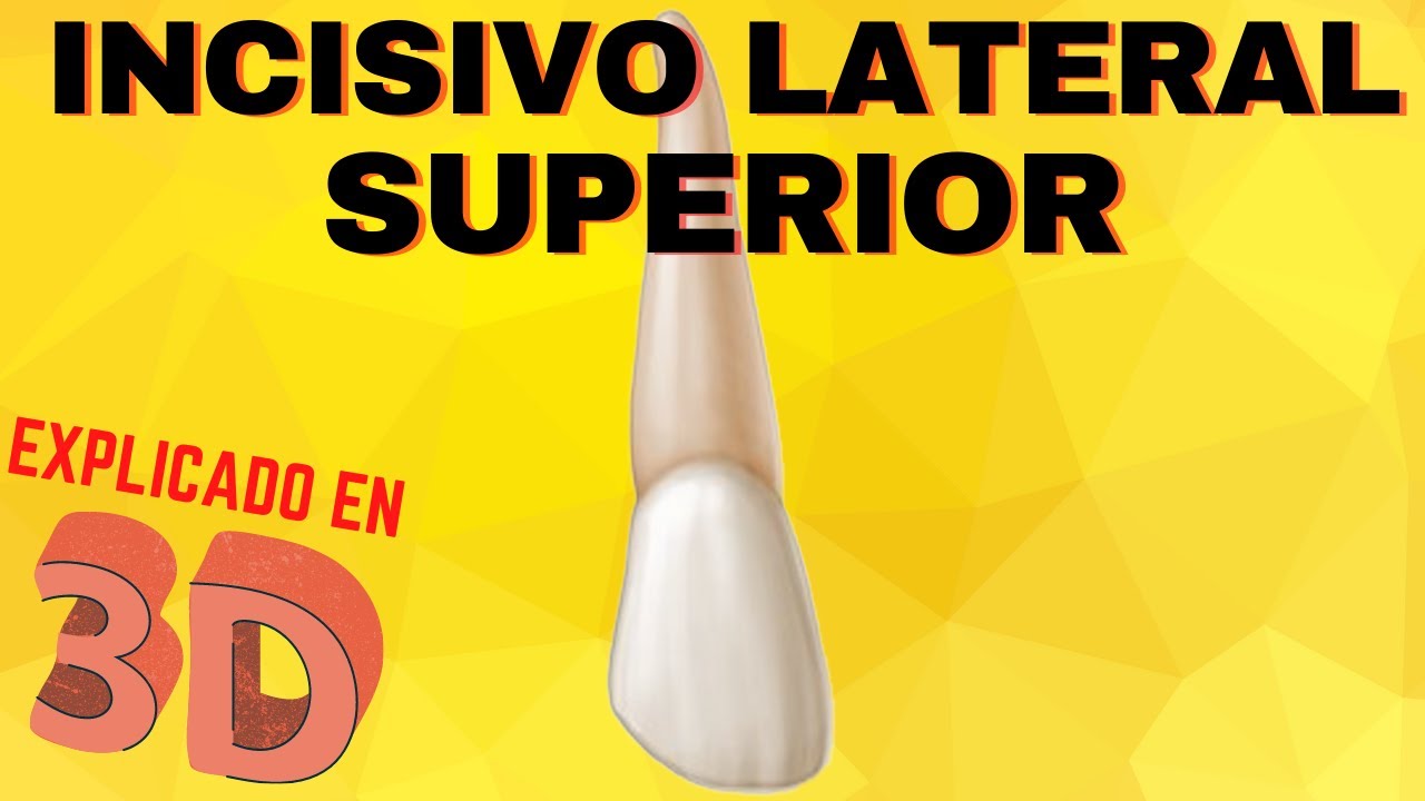 INCISIVO LATERAL SUPERIOR  [ EXPLICADO EN 3D ] Anatomía Dental Incisivo Lateral Superior