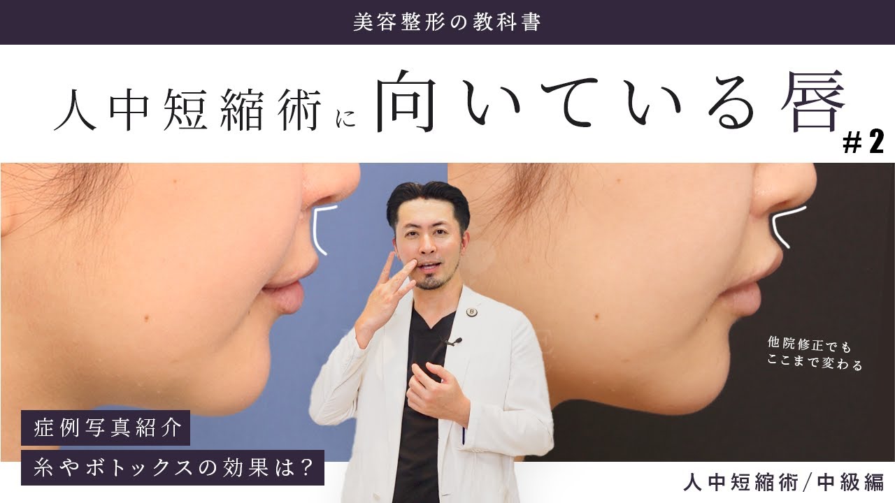 vol.9 あなたの唇タイプは？人中短縮術【中級編】自分の唇のタイプを知ろう/症例紹介/人中短縮Q&A